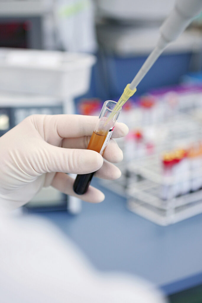 Hands of a lab technician in clinical bioanalysis facility holding a serum containing tube and a pipette.