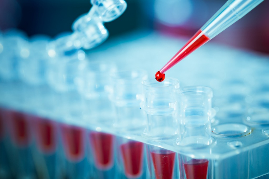 Blood is pipetted in a test tube during immunogenicity assessment