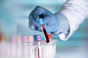 Lab assistant handling blood samples for clinical bioanalysis in a rack